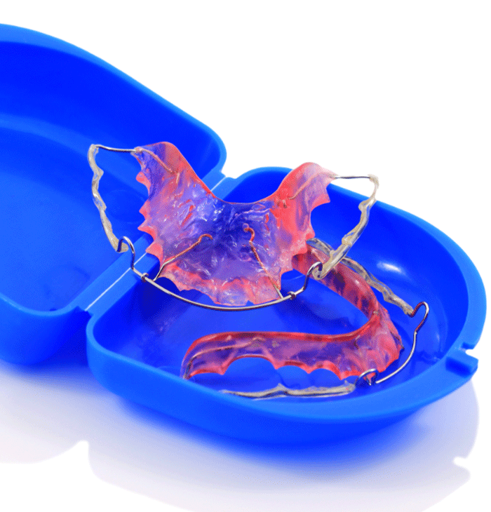 set of retainers in a blue case on a reflective white background